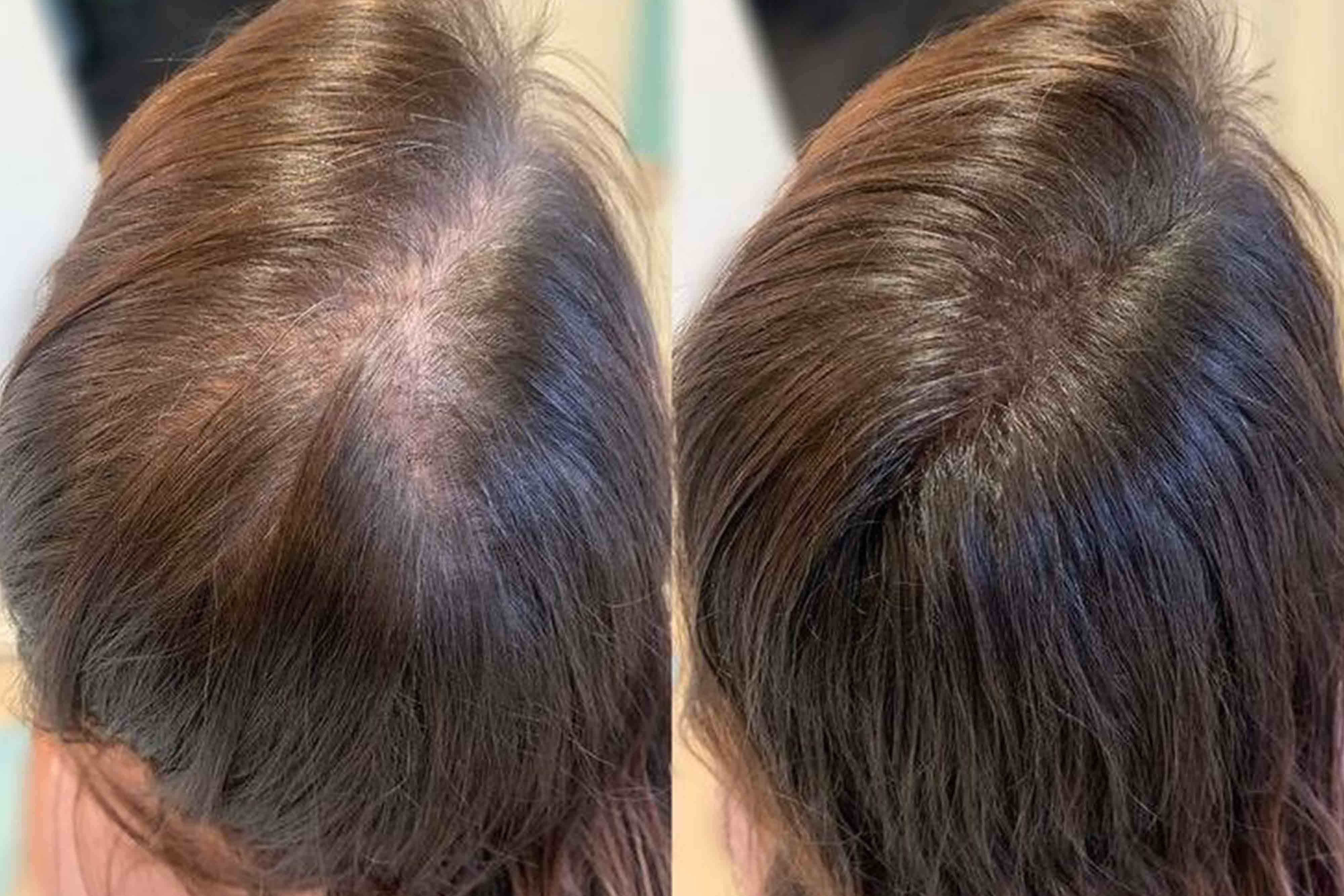 Alexandra's hair transformation