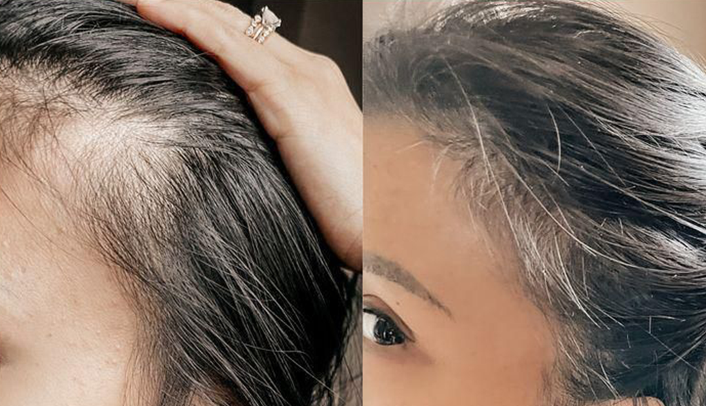 Denise's hair transformation