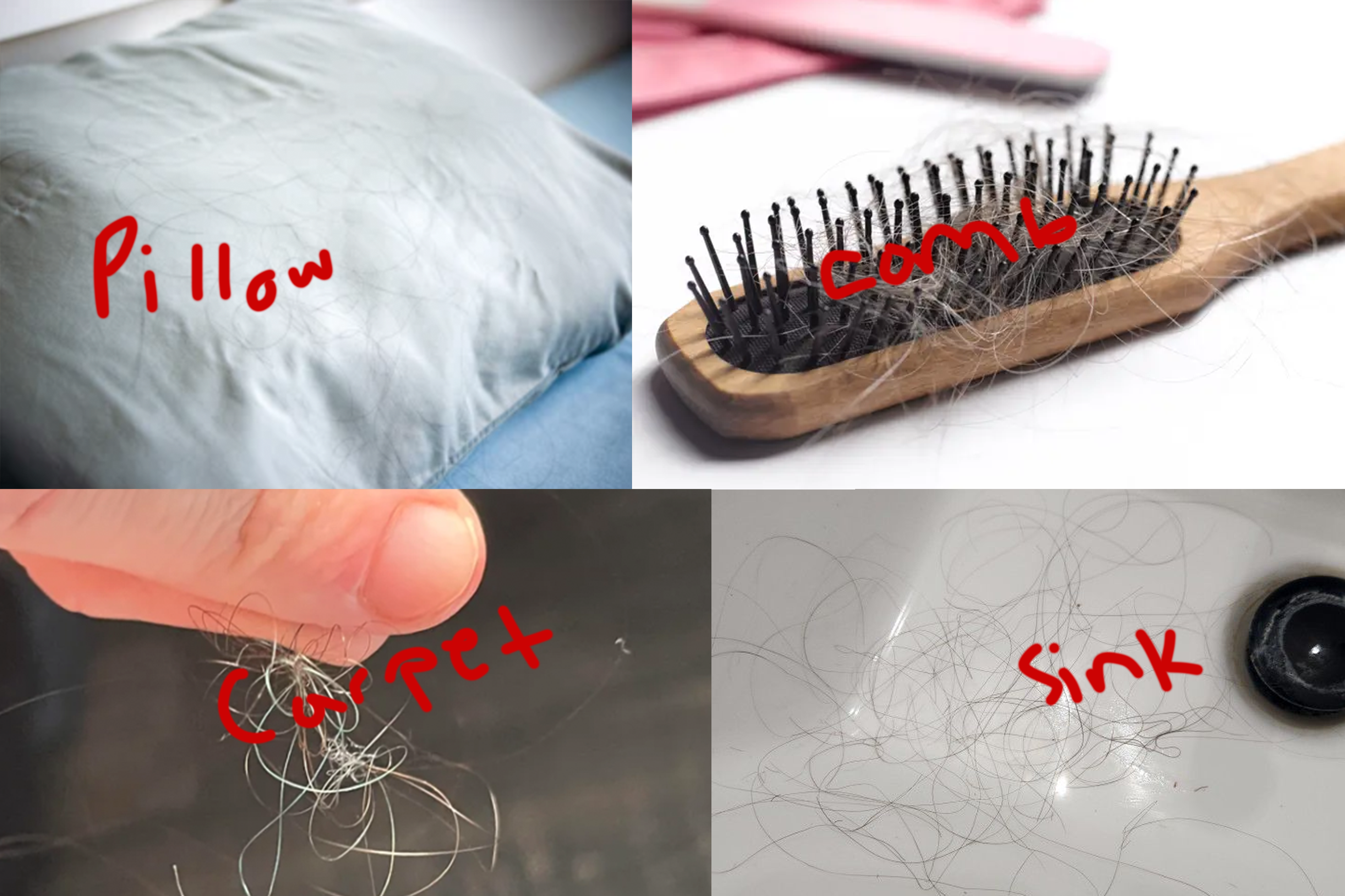 Hair shedding everywhere